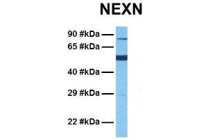 Host:  Rabbit  Target Name:  NEXN  Sample Tissue:  Human Fetal Lung  Antibody Dilution:  1.