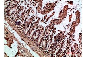 Immunohistochemical analysis of paraffin-embedded human-colon, antibody was diluted at 1:200