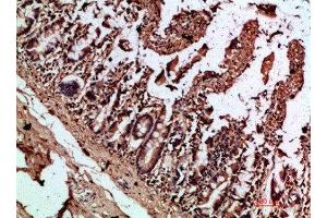 Immunohistochemical analysis of paraffin-embedded human-colon, antibody was diluted at 1:200 (IL17C anticorps  (AA 81-130))