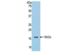 Detection of Recombinant CDHE, Rat using Polyclonal Antibody to E-cadherin