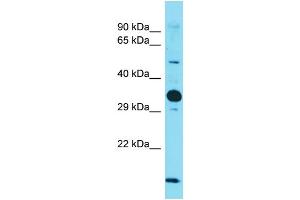 Host: Rabbit  Target Name: Nus1  Sample Tissue: Mouse Heart lysates  Antibody Dilution: 1. (Nogo B Receptor anticorps  (Middle Region))