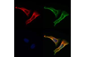 C19orf52 Antibody staining Hela cells by IF/ICC.