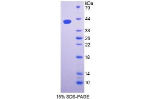 SDS-PAGE analysis of Mouse SPTLC1 Protein. (SPTLC1 Protéine)