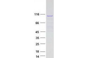 Validation with Western Blot