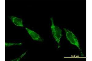 Immunofluorescence of purified MaxPab antibody to UQCRC2 on HeLa cell.