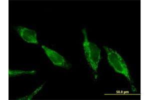 Immunofluorescence of purified MaxPab antibody to UQCRC2 on HeLa cell. (UQCRC2 anticorps  (AA 1-453))