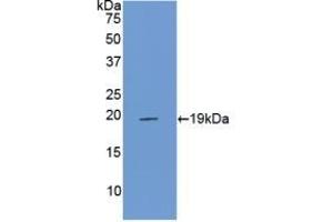 Detection of Recombinant PROCR, Rat using Polyclonal Antibody to Endothelial protein C receptor (EPCR) (PROCR anticorps  (AA 59-217))