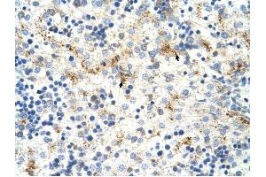 MOV10 antibody was used for immunohistochemistry at a concentration of 4-8 ug/ml to stain Hepatocytes (arrows) in Human Liver.