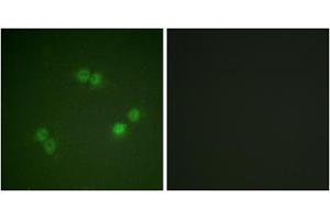 Immunofluorescence analysis of A549 cells, using SF1 (Phospho-Ser82) antibody.