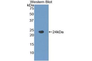 Detection of Recombinant TACR2, Human using Polyclonal Antibody to Tachykinin Receptor 2 (TACR2) (TACR2 anticorps  (AA 92-290))
