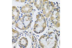 Immunohistochemistry of paraffin-embedded human stomach using MRPL1 antibody. (MRPL1 anticorps  (AA 51-325))