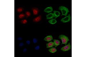 ABIN6262516 and ABIN6269410 staining Hela cells by IF/ICC.