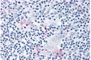 Anti-ROR Gamma antibody  ABIN1049298 IHC staining of human thymus. (RORC anticorps  (Modulating Domain))