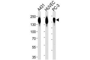 Western blot analysis of lysate from A431, HUVEC, PC3 cell line (left to right) using anti-EGFR antibody diluted at 1:1000 for each lane.