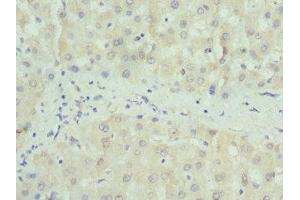 Immunohistochemistry of paraffin-embedded human liver tissue using ABIN7160326 at dilution of 1:100 (PAICS anticorps  (AA 176-425))