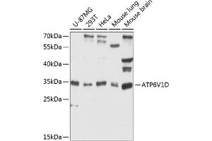 Western blot analysis of extracts of various cell lines, using V1D antibody (ABIN6127397, ABIN6137348, ABIN6137349 and ABIN6216761) at 1:3000 dilution. (ATP6V1D anticorps  (AA 1-247))