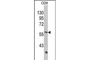 Western blot analysis of KRT10 antibody (Center) (ABIN390659 and ABIN2840954) in CEM cell line lysates (35 μg/lane). (Keratin 10 anticorps  (AA 318-346))