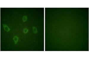 Immunofluorescence analysis of HuvEc cells, using Caspase 9 (Ab-125) Antibody. (Caspase 9 anticorps  (AA 91-140))