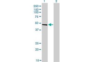 Western Blot analysis of CREB3 expression in transfected 293T cell line by CREB3 monoclonal antibody (M01), clone 3H5.