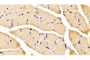 Detection of NT5C in Mouse Skeletal muscle Tissue using Polyclonal Antibody to 5',3'-Nucleotidase, Cytosolic (NT5C) (NT5C anticorps  (AA 12-200))