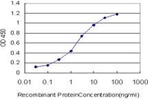Detection limit for recombinant GST tagged STAG1 is approximately 0. (Stromal Antigen 1 anticorps  (AA 1112-1221))