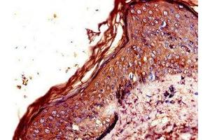 Immunohistochemistry of paraffin-embedded human skin tissue using ABIN7146648 at dilution of 1:100 (CNR2 anticorps  (AA 305-360))