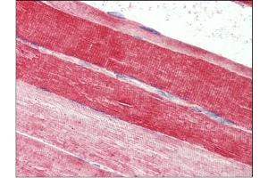 Skeletal muscle, Human: Formalin-Fixed, Paraffin-Embedded (FFPE) (FABP7 anticorps  (C-Term))