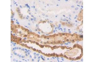Used in DAB staining on fromalin fixed paraffin- embedded Kidney tissue (HSPA6 anticorps  (AA 1-387))