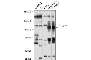 Western blot analysis of extracts of various cell lines, using SMPD3 antibody (ABIN6128775, ABIN6148146, ABIN6148147 and ABIN6214354) at 1:1000 dilution. (SMPD3 anticorps  (AA 416-655))