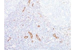 Formalin-fixed, paraffin-embedded human tonsil stained with VEGF antibody (VEGF/1063). (VEGFA anticorps)