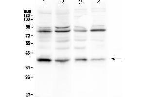 Western blot analysis of IKB Alpha using anti- IKB Alpha antibody .