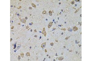 Immunohistochemistry of paraffin-embedded Mouse brain using EIF4A2 Polyclonal Antibody at dilution of 1:100 (40x lens).
