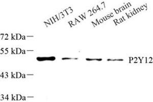 Western blot analysis of P2Y12 (ABIN7075321) at dilution of 1: 250 (P2RY12 anticorps)