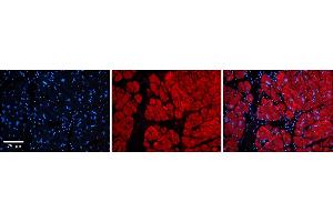 Rabbit Anti-Tnks Antibody  Catalog Number: ARP33978_P050 Formalin Fixed Paraffin Embedded Tissue: Human Adult heart  Observed Staining: Cytoplasmic Primary Antibody Concentration: 1:600 Secondary Antibody: Donkey anti-Rabbit-Cy2/3 Secondary Antibody Concentration: 1:200 Magnification: 20X Exposure Time: 0. (TNKS anticorps  (Middle Region))
