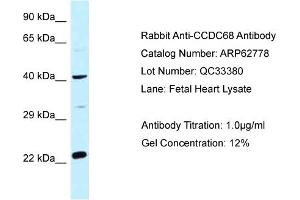 Western Blotting (WB) image for anti-Coiled-Coil Domain Containing 68 (CCDC68) (Middle Region) antibody (ABIN2774351) (CCDC68 anticorps  (Middle Region))