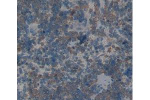 Used in DAB staining on fromalin fixed paraffin- embedded Kidney tissue (AANAT anticorps  (AA 22-235))