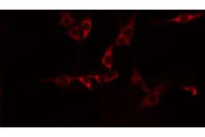 ABIN6274596 staining HepG2 by IF/ICC.