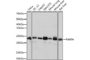 Western blot analysis of extracts of various cell lines, using RA Rabbit mAb (ABIN7269817) at 1:1000 dilution. (RAB9A anticorps)