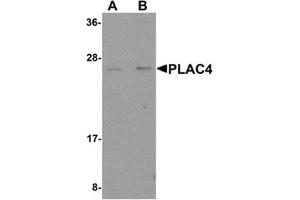 Western blot analysis of PLAC4 in human placenta tissue lysate with PLAC4 antibody at (A) 1 and (B) 2 μg/ml. (PLAC4 anticorps  (Center))