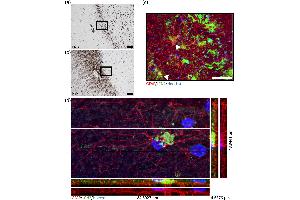 Lipocalin 2 (LCN2) expression in the active rim of multiple sclerosis (MS) lesions.