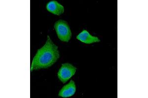 IF analysis of DAB2 using anti-DAB2 antibody (ABIN7602613). (DAB2 anticorps  (AA 89-770))