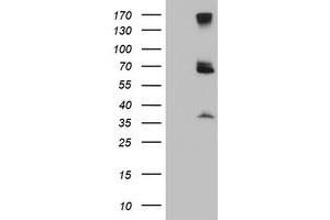 Western Blotting (WB) image for anti-Proteasome (Prosome, Macropain) 26S Subunit, Non-ATPase, 3 (PSMD3) antibody (ABIN1499980) (PSMD3 anticorps)
