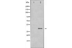 Western blot analysis of RFA2 expression in K562 whole cell lysates,The lane on the left is treated with the antigen-specific peptide. (RPA2 anticorps  (N-Term))