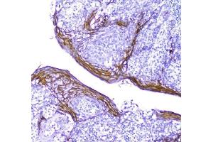 IHC analysis of Periplakin using anti-Periplakin antibody (ABIN5518787). (PPL anticorps  (C-Term))