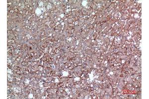 Immunohistochemistry (IHC) analysis of paraffin-embedded Human Liver, antibody was diluted at 1:100. (CD147 anticorps  (Internal Region))