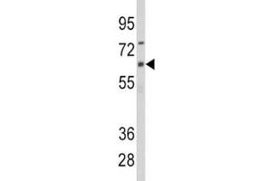 Western blot analysis of CYP1B1 antibody and CEM lysate