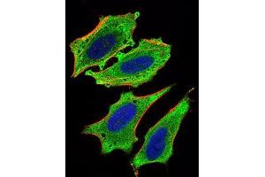 Immunofluorescence analysis of Hela cells using MLXIPL mouse mAb (green).