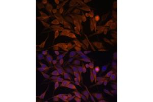 Immunofluorescence analysis of HeLa cells using CACYBP antibody  at dilution of 1:100.