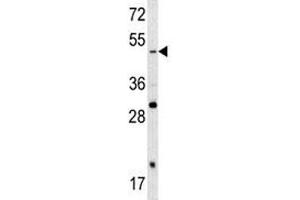 Western blot analysis of SOX4 antibody and A2058 lysate. (SOX4 anticorps  (AA 86-114))