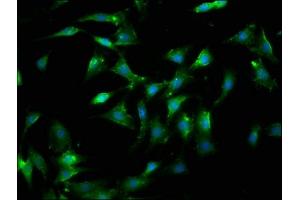 Immunofluorescence staining of NIH/3T3 cells with ABIN7153467 at 1:100, counter-stained with DAPI.